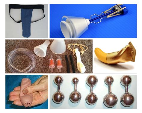 Purpose Most hypospadias repairs performed in the United States involve the removal of any foreskin that is not used in the repair, resulting in a circumcised penis. . Where to get foreskin restoration surgery